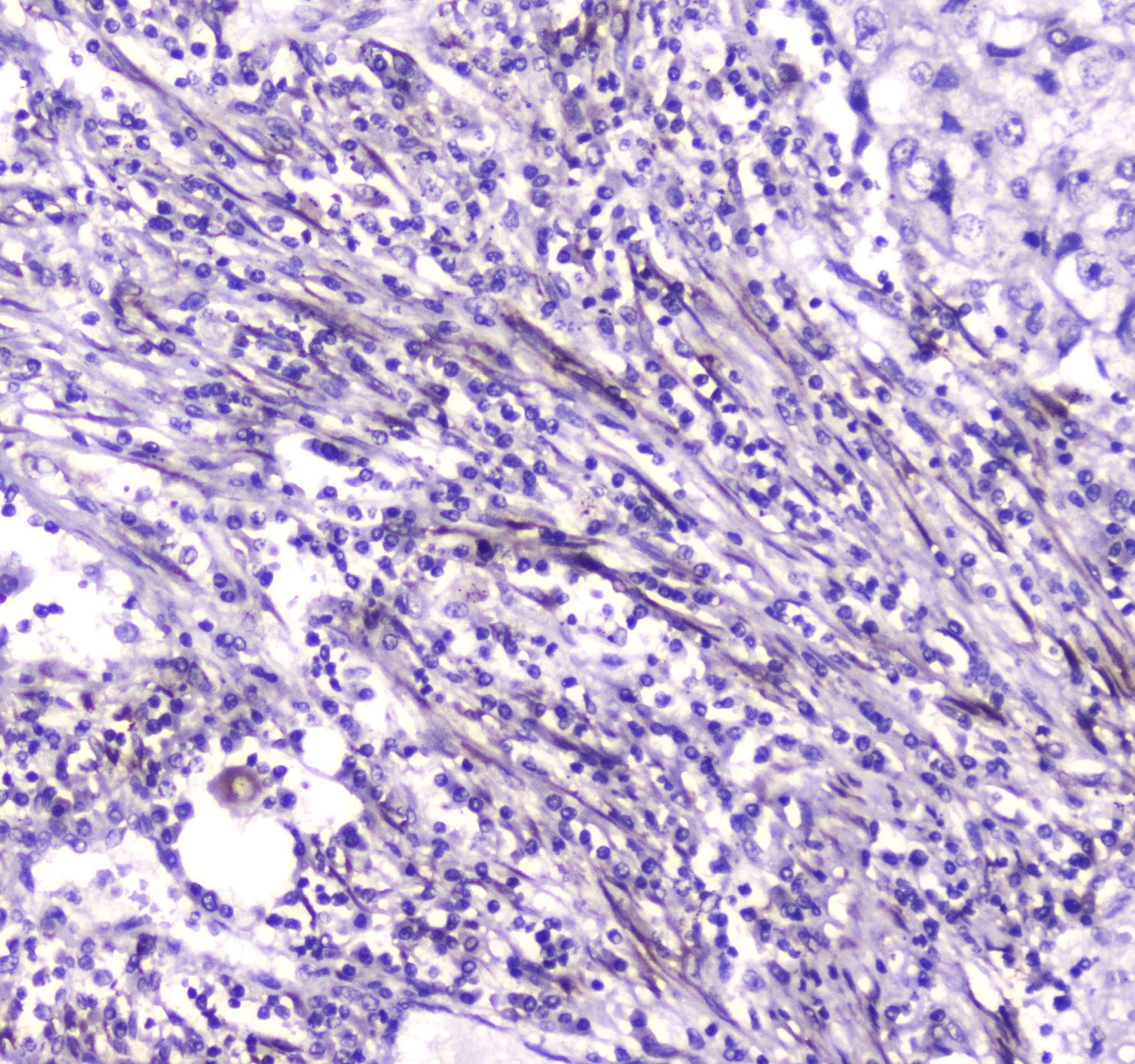Carboxylesterase 1 / CES1 Antibody
