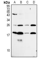 Polyclonal Rabbit anti-Human MRPL50 Antibody (WB)