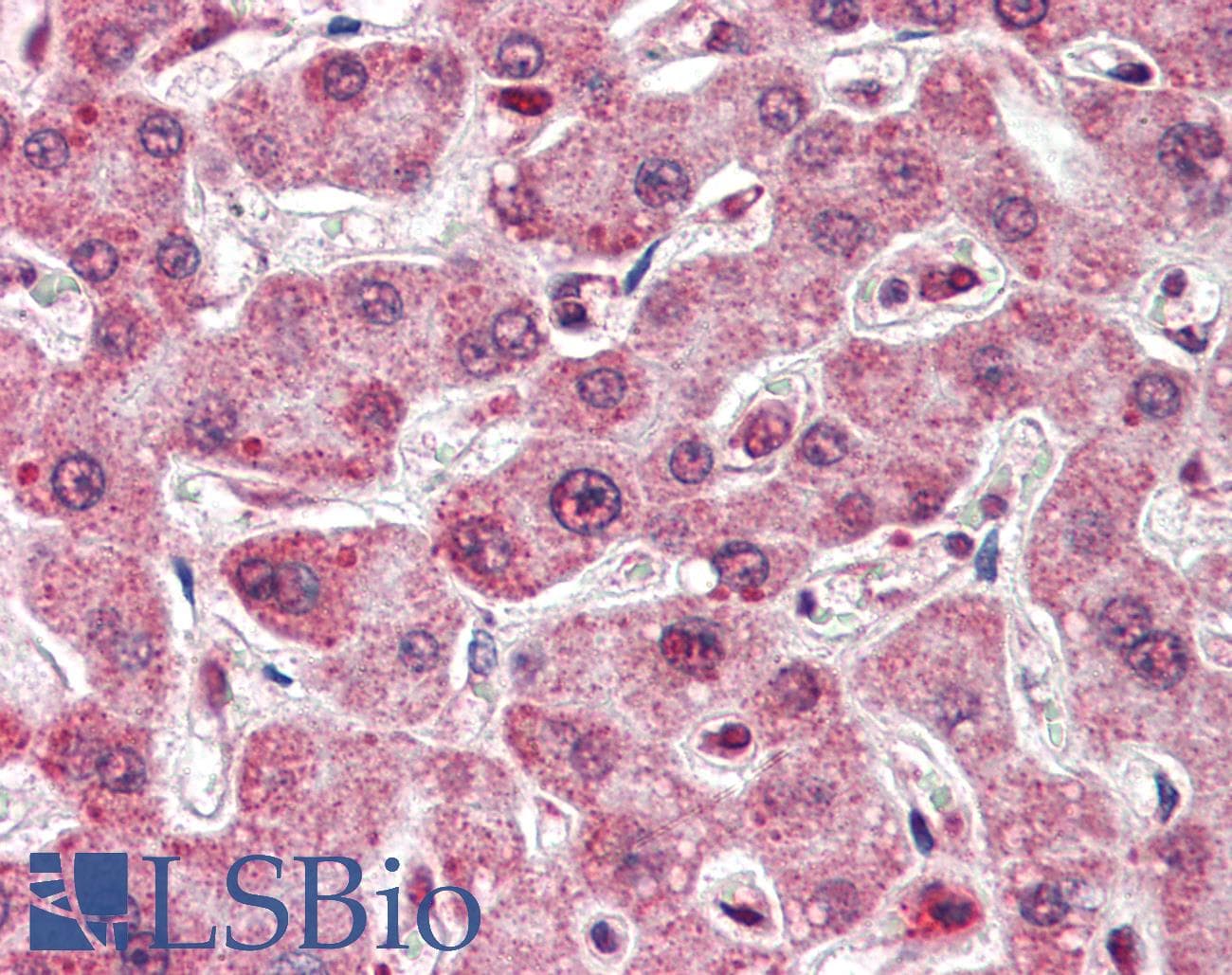 IHC-plus™ Polyclonal Rabbit anti-Human TOCA1 / FNBP1L Antibody (IHC, IF, WB)