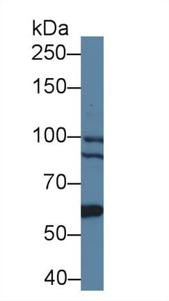 BCOR Antibody (aa1553-1755, APC)
