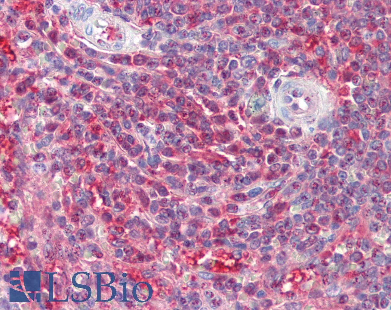IHC-plus™ Polyclonal Goat anti-Human PSME2 Antibody (aa223-236, IHC, WB)
