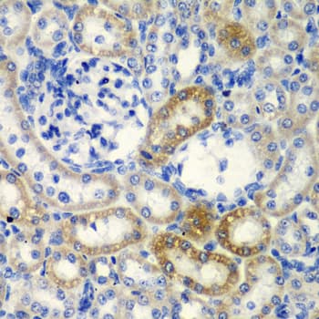 DDX1 Antibody