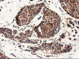 CLPP Antibody (clone OTI1G9)