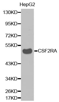 CSF2RA / CD116 Antibody
