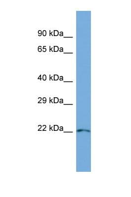 PARVG Antibody (aa38-87)