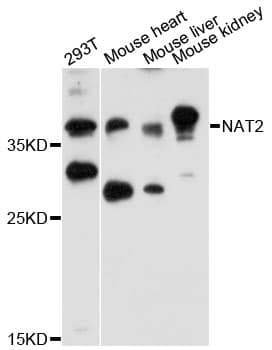 NAT2 Antibody