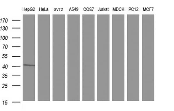 TXNDC5 / ERP46 Antibody (clone OTI1C1)