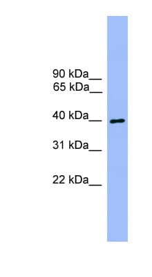 Polyclonal Rabbit anti-Human ATG3 Antibody (aa91-140, WB)