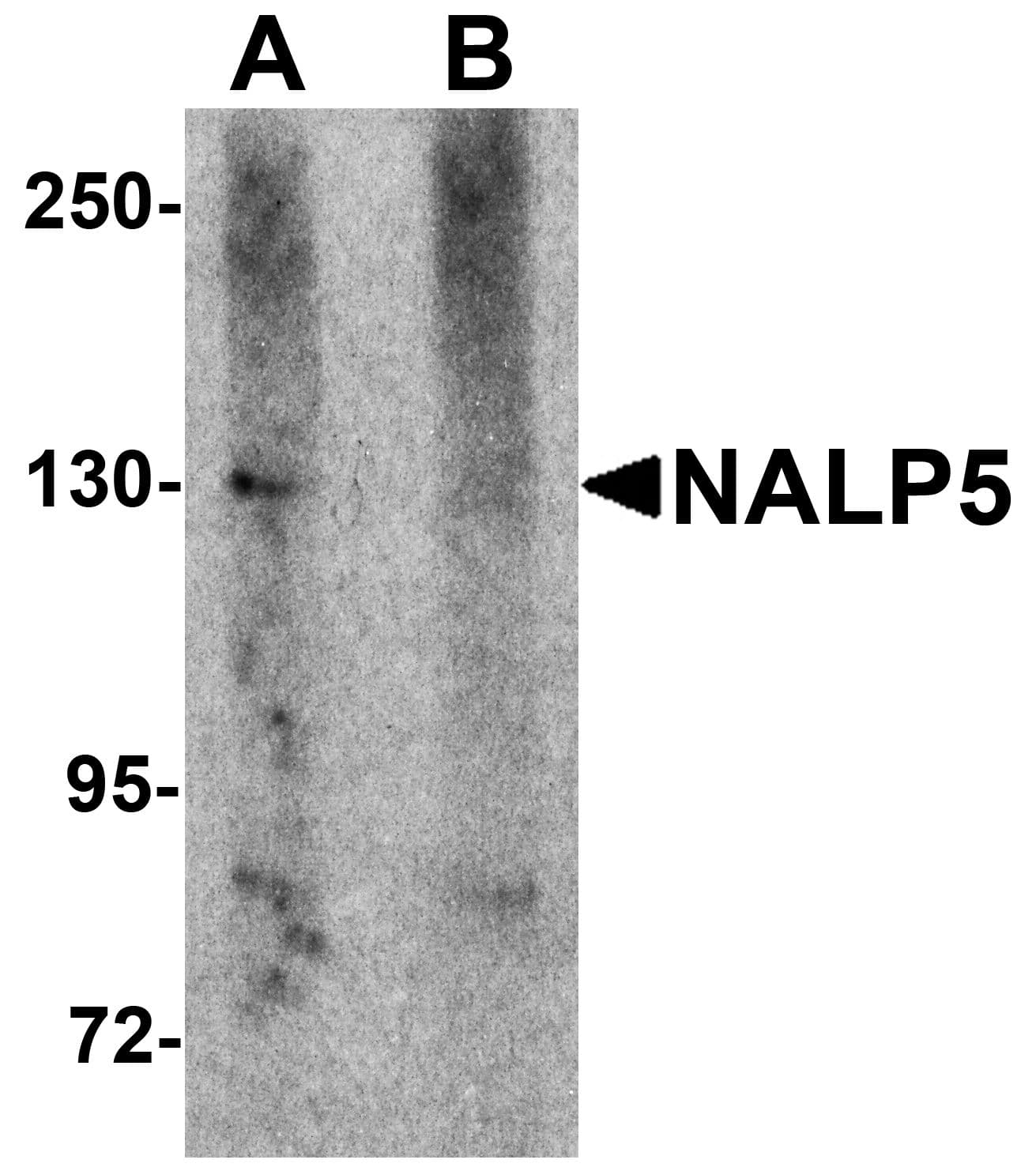 NLRP5 / NALP5 Antibody