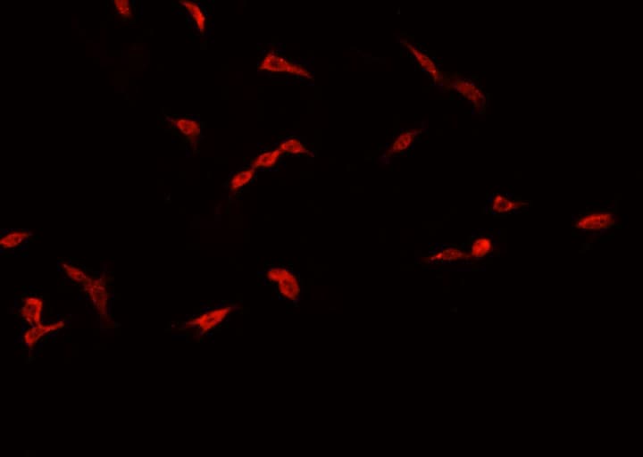 Polyclonal Rabbit anti-Human CREBBP / CREB Binding Protein Antibody (IHC, IF, WB)