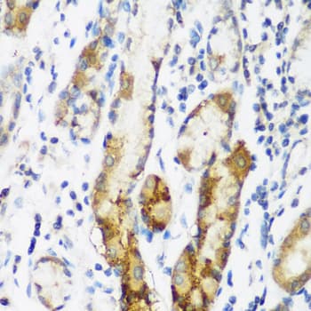 NAT15 Antibody