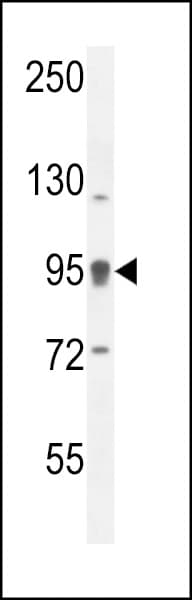 Polyclonal Rabbit anti-Human CENTB1 / ACAP1 Antibody (aa96-125, IHC, WB)