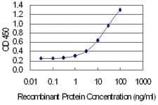 Monoclonal Mouse anti-Human XPA Antibody (clone 2E4, IF, WB)