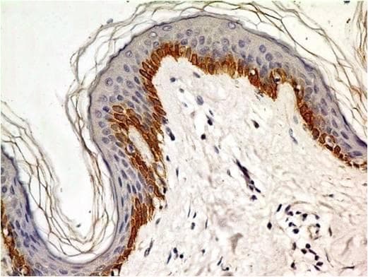 Monoclonal Mouse anti-Human TLR4 Antibody (Azide-free, IHC)