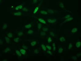 C2orf40 / ECRG4 Antibody (clone OTI3B10)