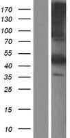 FETUB / Fetuin B Protein (Over-Expression Lysate Myc-DDK (Flag))