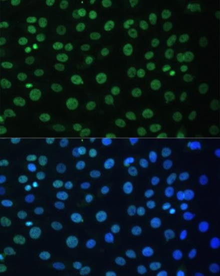 HNRNPD / AUF1 Antibody