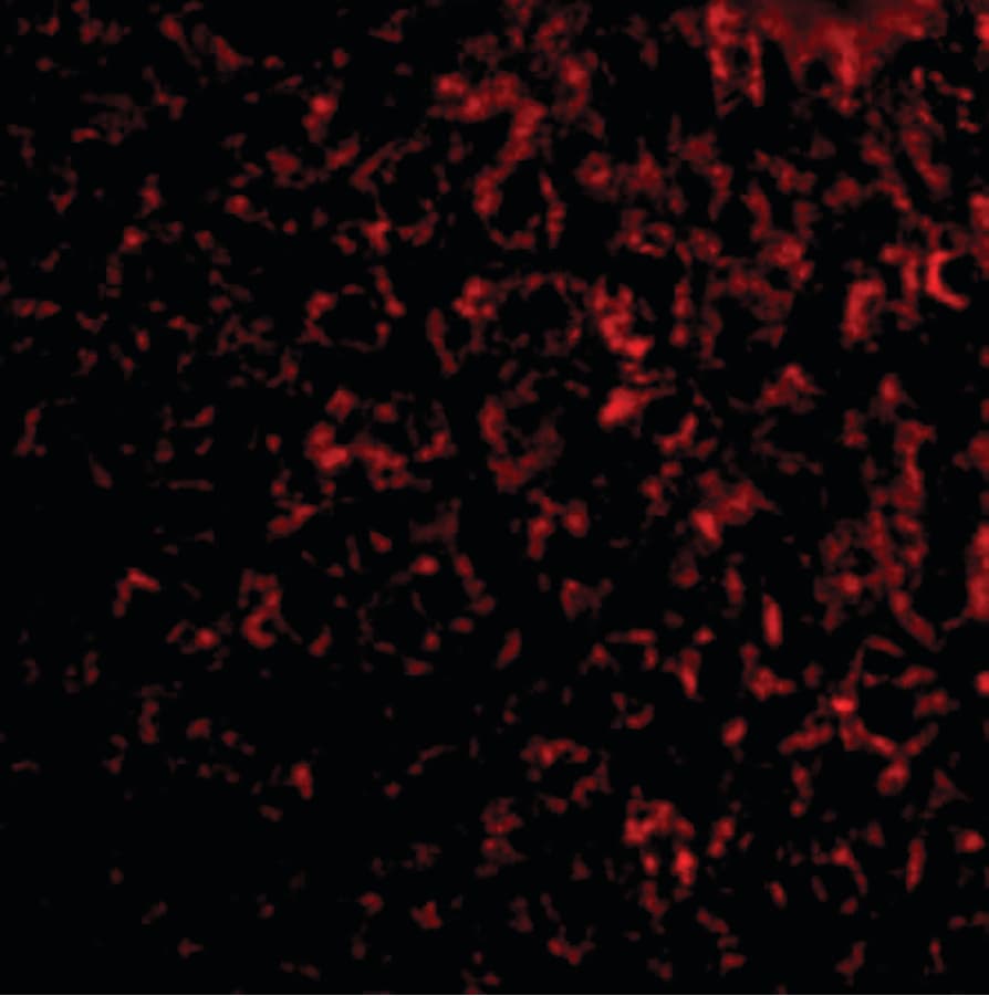 TEM7 Antibody