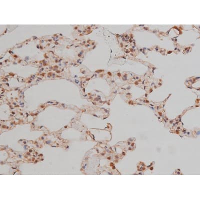 Polyclonal Rabbit anti-Human SP1 Antibody (phospho-Thr739, IHC, IF, WB)