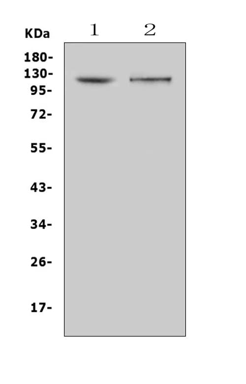 DDR2 Antibody