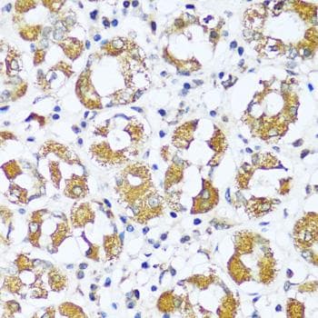 Polyclonal Rabbit anti-Human ATP5I Antibody (IHC, IF)