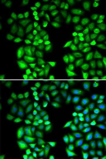 Polyclonal Rabbit anti-Human DNAJB1 / Hsp40 Antibody (IHC, IF, WB)