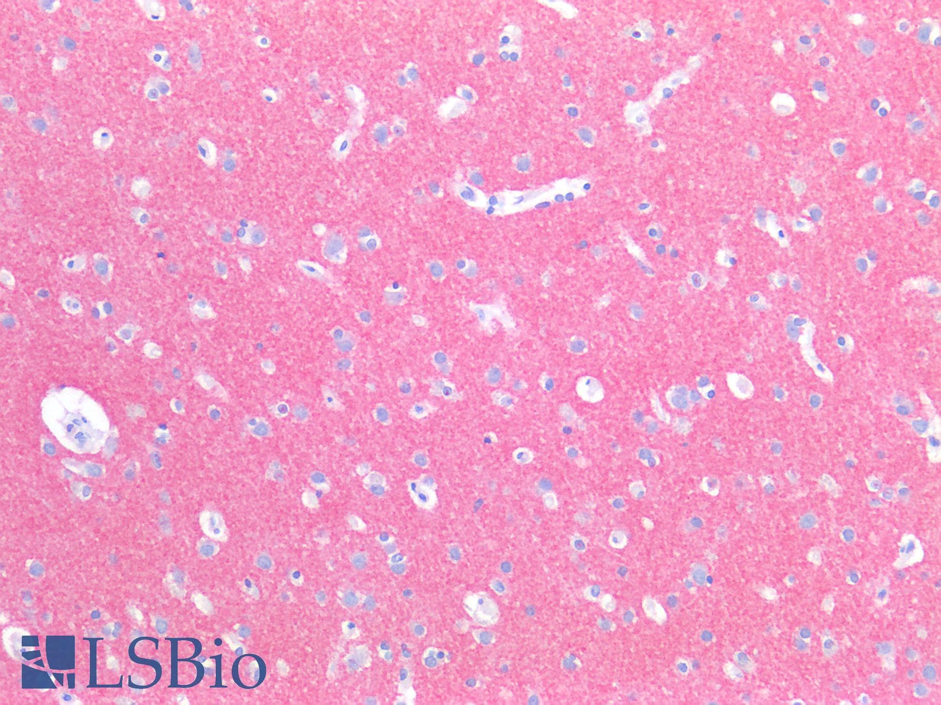 PathPlus™ Polyclonal Rabbit anti-Human SYT1 / Synaptotagmin Antibody (IHC, IF, WB)