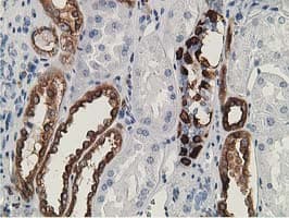 SH2B3 / LNK Antibody (clone OTI2D8)