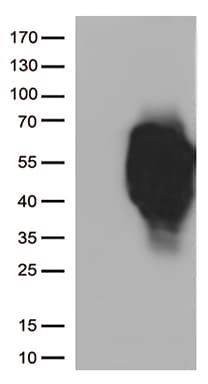 Monoclonal Mouse anti-Human HAVCR2 / TIM-3 Antibody (clone OTI1G6, WB)