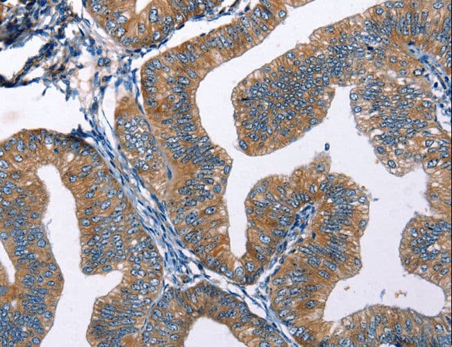 Polyclonal Rabbit anti-Human EDN2 / Endothelin 2 Antibody (IHC)