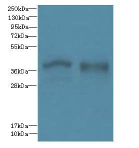 Polyclonal Rabbit anti-Human FPR1 / FPR Antibody (IHC, WB)