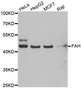 Polyclonal Rabbit anti-Human FAH Antibody (IHC, IF, WB)