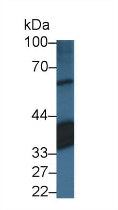 RLBP1 / CRALBP Antibody (APC)