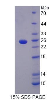 Human LETMD1 / HCCR1 Protein (Recombinant His-T7)