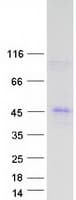 Human TMEM231 Protein (Recombinant Myc-DDK (Flag))