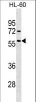 PathPlus™ Polyclonal Rabbit anti-Human ALK2 / ACVR1 Antibody (aa138-170, IHC, WB)