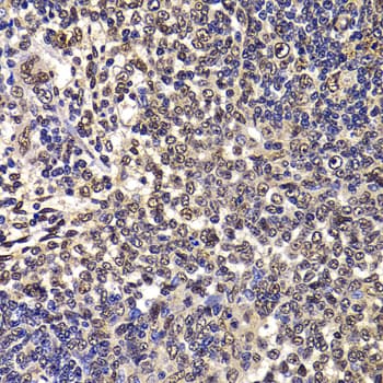 Polyclonal Rabbit anti-Human WBSCR22 Antibody (IHC, IF, WB)