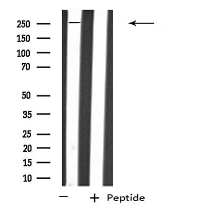 PTPRZ1 / Phosphacan Antibody
