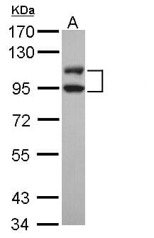 Polyclonal Rabbit anti-Human LIG3 / DNA Ligase III Antibody (aa116-433, IHC, WB)