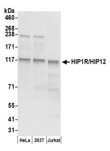 HIP1R Antibody (aa300-350)
