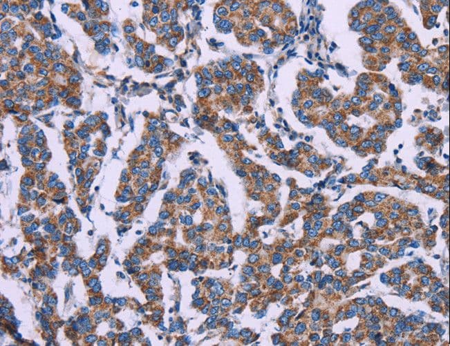 Polyclonal Rabbit anti-Human AGFG1 Antibody (IHC, WB)