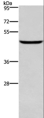 DMRTA3 / DMRT3 Antibody