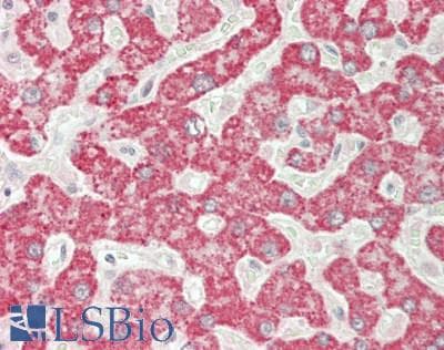 IHC-plus™ Polyclonal Rabbit anti-Human RAB35 Antibody (Internal, IHC, WB)