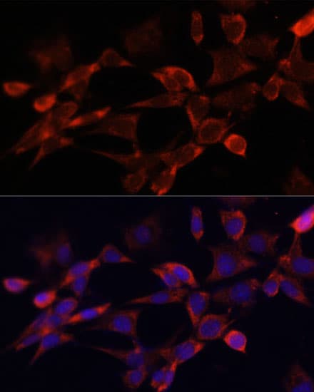 GLI / GLI1 Antibody