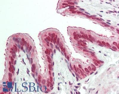 Polyclonal Rabbit anti-Human EXOSC10 Antibody (aa756-805, IHC, WB)