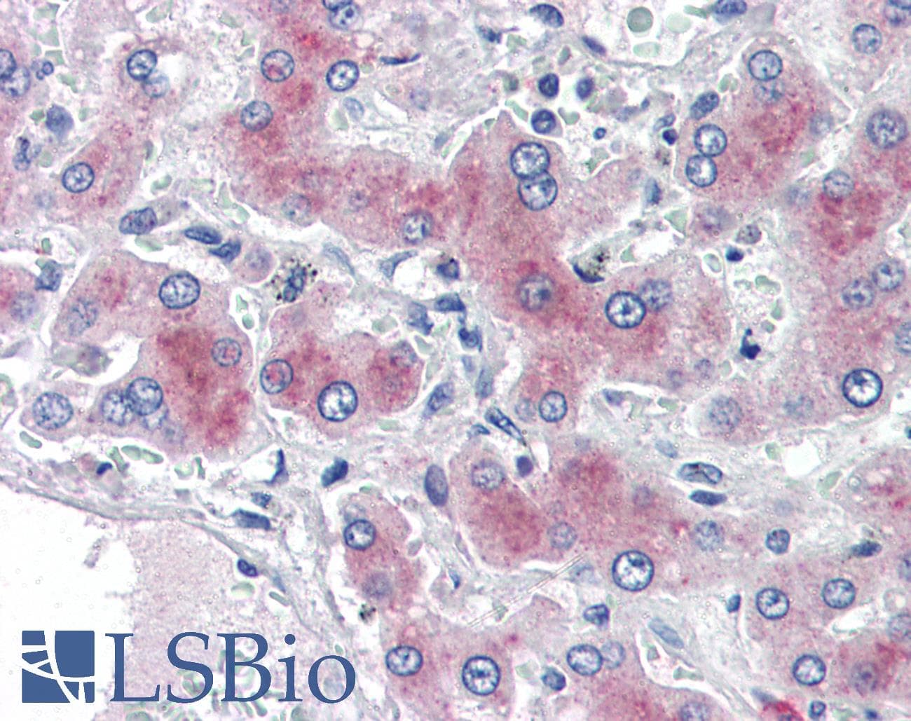 IHC-plus™ Polyclonal Goat anti-Human PCK1 Antibody (aa513-524, IHC)