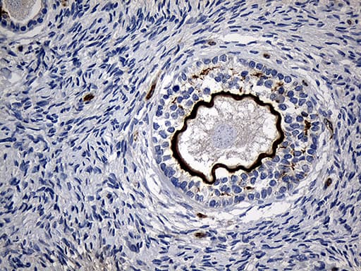 Monoclonal Mouse anti-Human MGP / Matrix Gla-Protein Antibody (clone OTI8D6, IHC, WB)