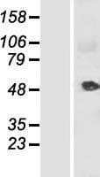 KRT34 / Keratin 34 / KRTHA4 Protein (Over-Expression Lysate Myc-DDK (Flag))
