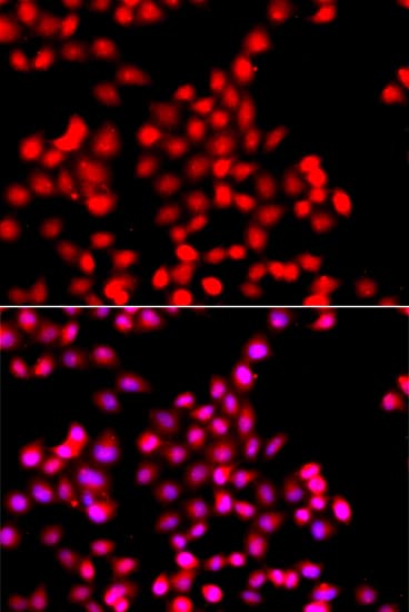 Polyclonal Rabbit anti-Human TTBK2 Antibody (IHC, IF, WB)