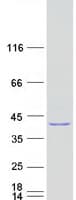 Human BCKDHB Protein (Recombinant Myc-DDK (Flag))